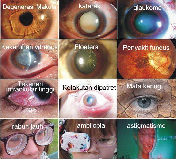 Japan Vision Drops — Rapidly Heals All Eye Conditions & Restores Vision