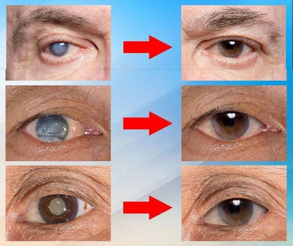 Japan Vision Drops — Rapidly Heals All Eye Conditions & Restores Vision